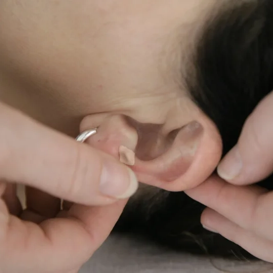 Auriculatherapie_2